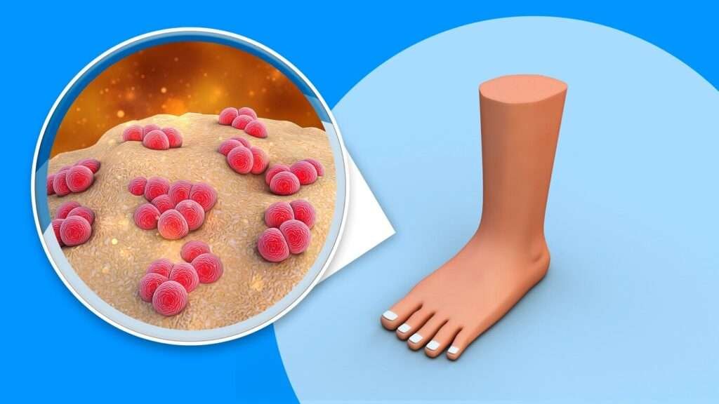 Understanding Uric Acid and Its Role in Kidney Stones: A Comprehensive Guide 4 The Biochemistry of Uric Acid