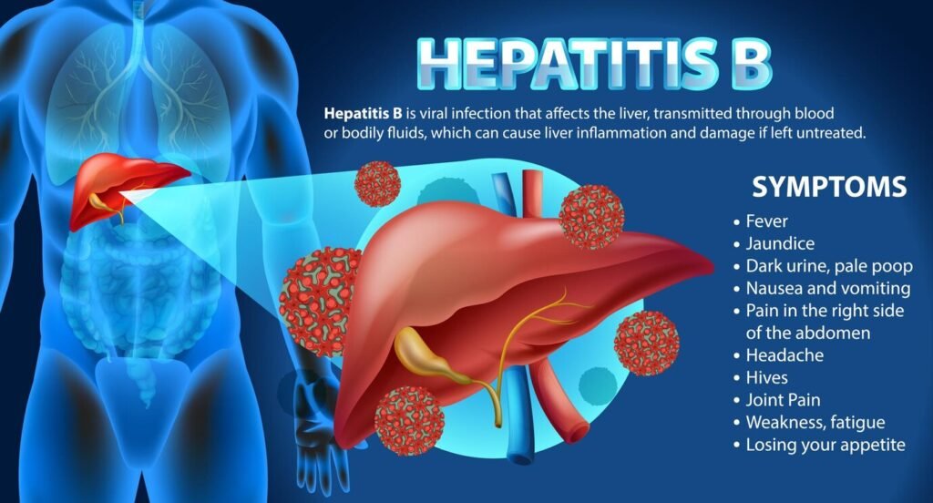 Understanding Hepatitis B Symptoms: 11 Symptoms & 03 Treatment Strategies 4 Hepatitis B Symptoms