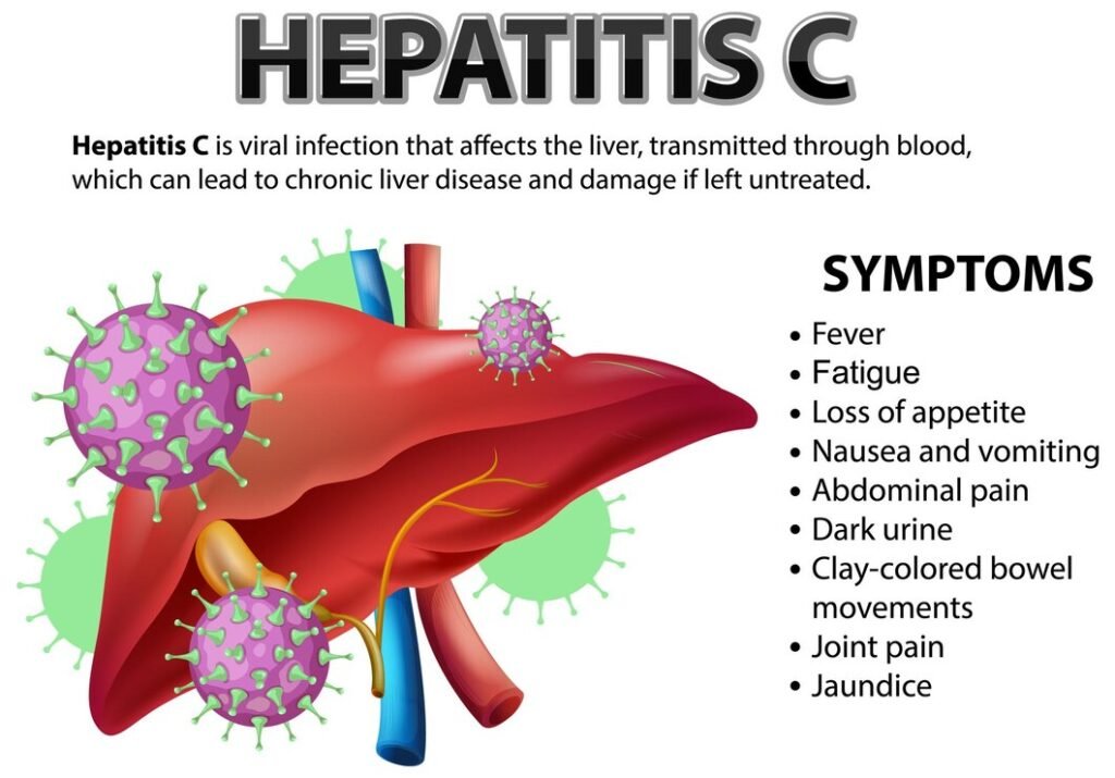 10 Hepatitis C Symptoms and Warning Signs: You Should Know 3 Hepatitis C Symptoms 1
